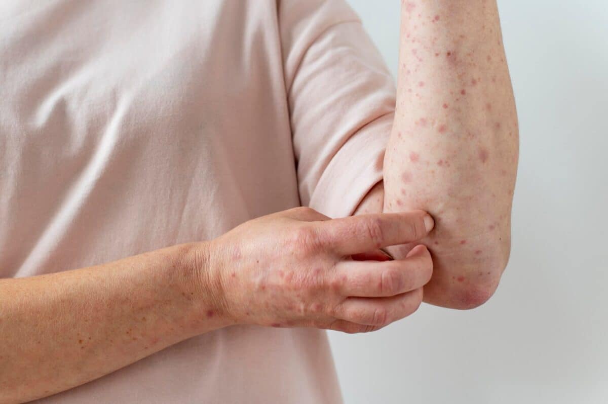 senior skin diseases