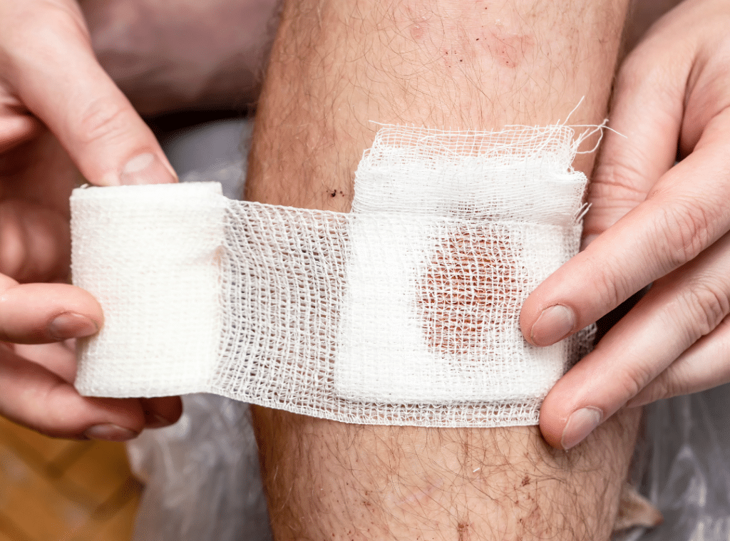 wound care for elderly thin skin