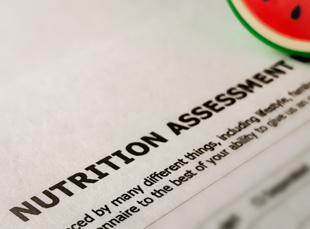 identify medications and their impact on elderly and nutrition