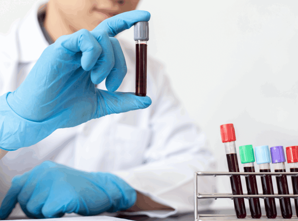 When Should the Elderly Stop Taking Blood Thinners Safely?
