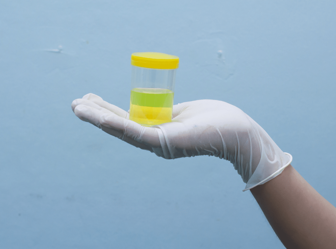 remove urine smell from elderly clothing